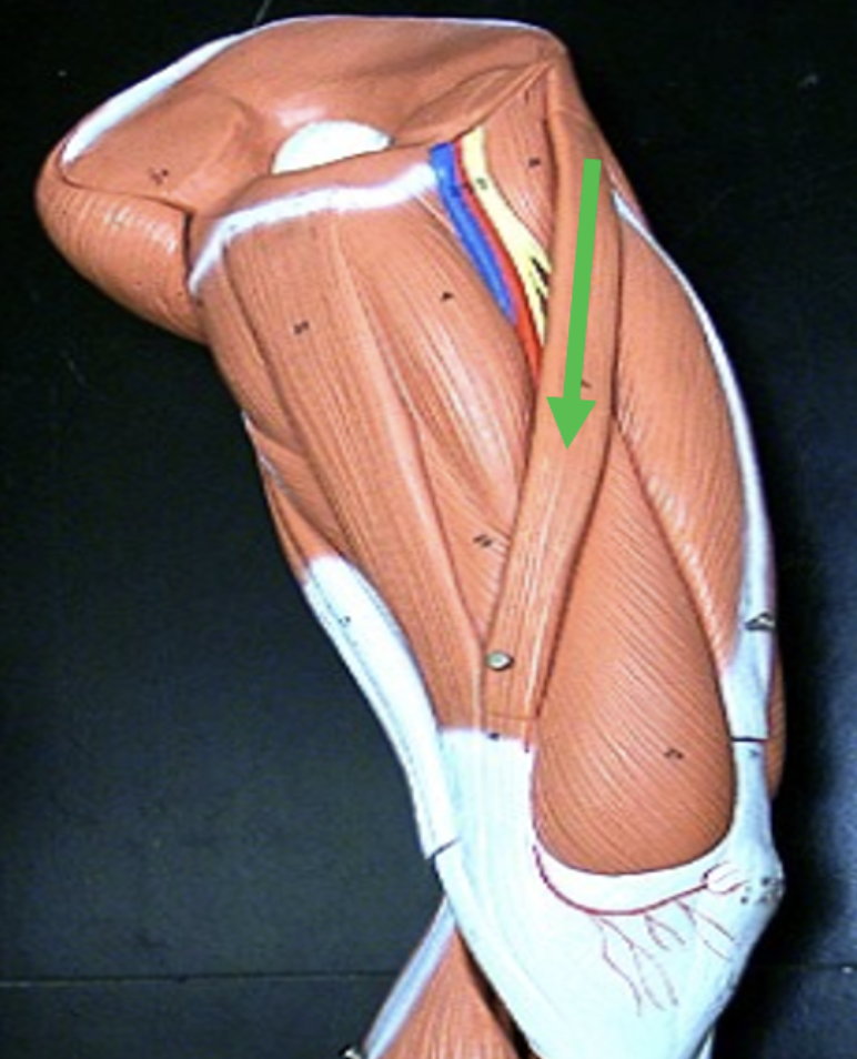 <p>Identify the muscle indicated by the pointer.</p>