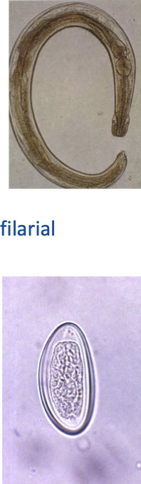 <ul><li><p>first image is adult form and second is egg </p></li><li><p>pinworm</p></li><li><p>Enterobiasis<span> (Pinworm infection)</span></p></li></ul><p></p>