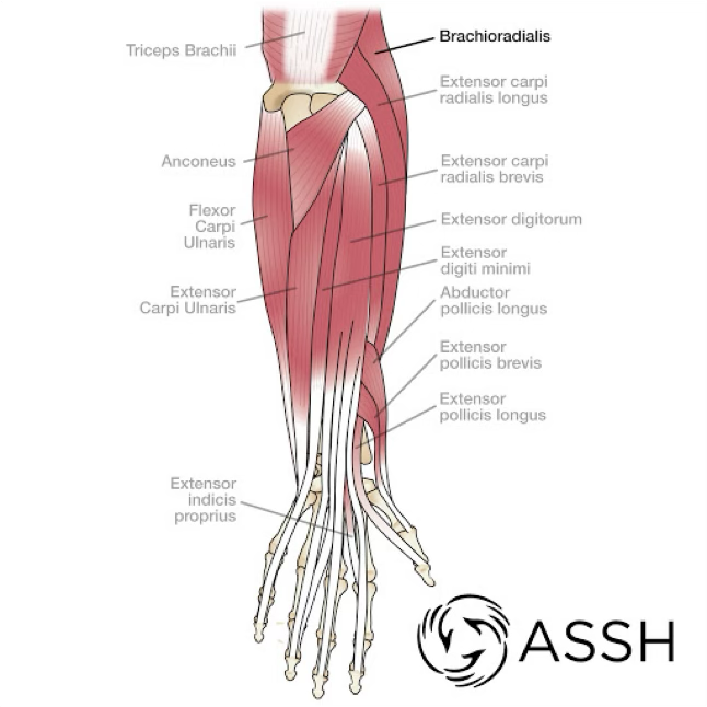<p>muscle strains and avulsions in arm</p>
