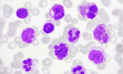 <p>RBCs will stain purple/blue/gray</p>