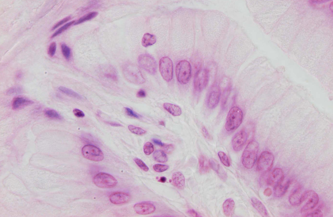 <p>welk soort weefsel</p>