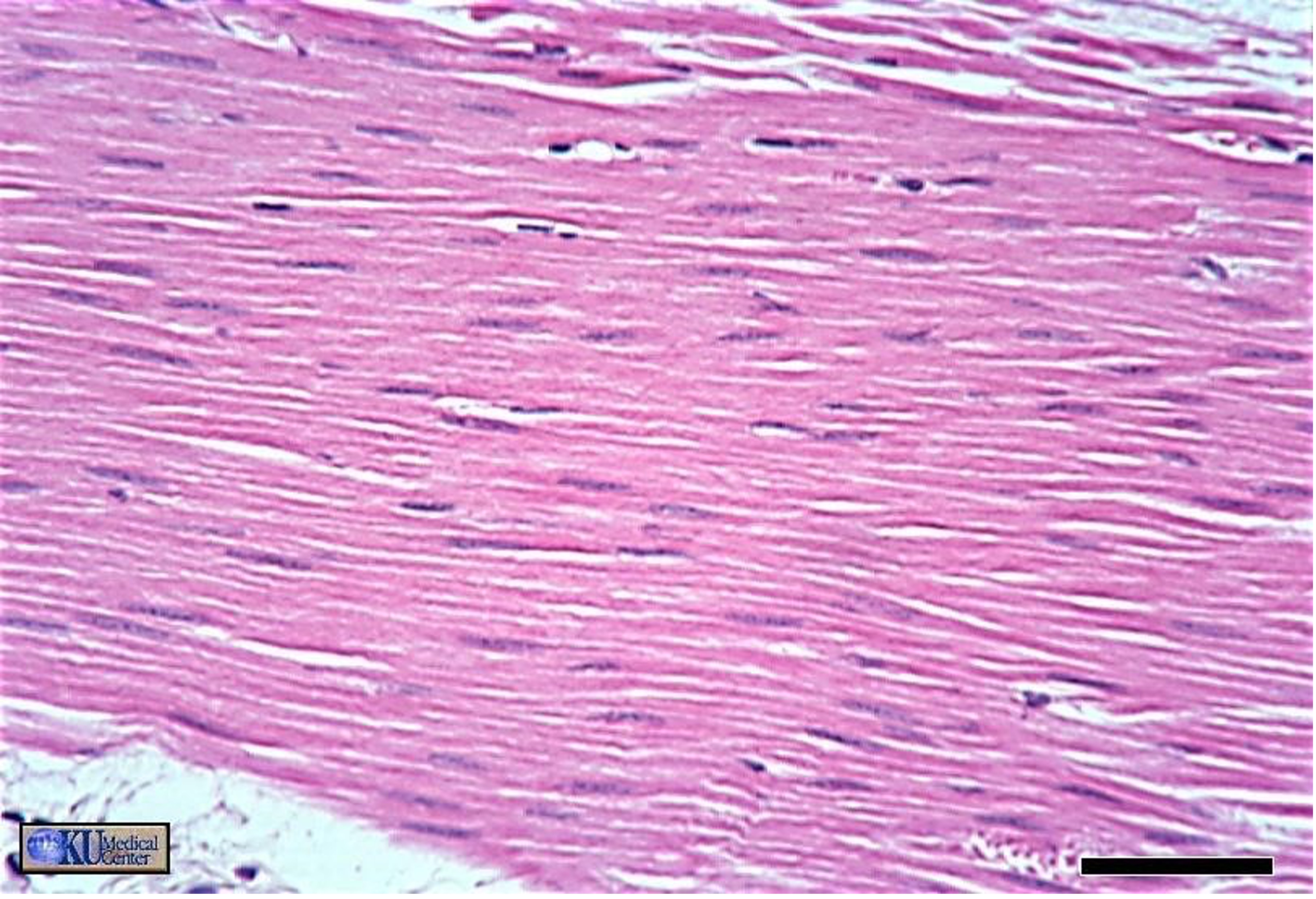 <p>What muscle tissue is this?</p>