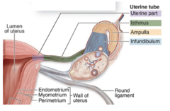 <p>What are the regions of the uterine tubes?</p>