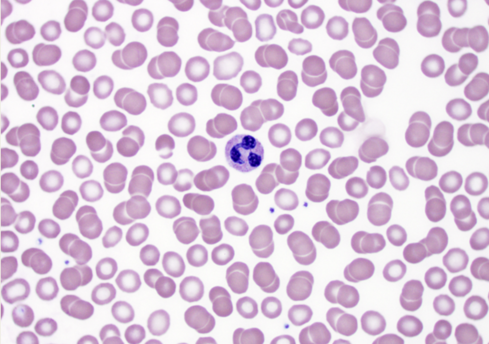 <p>Neutrophils</p><p>■ 3-5-lobed XX</p><p>■ XX</p><p>■ Normally, the first to</p><p>XX at the site of an</p><p>XX</p><p>■ Ingest XX and</p><p>release XX to kill</p><p>XX</p><p></p>