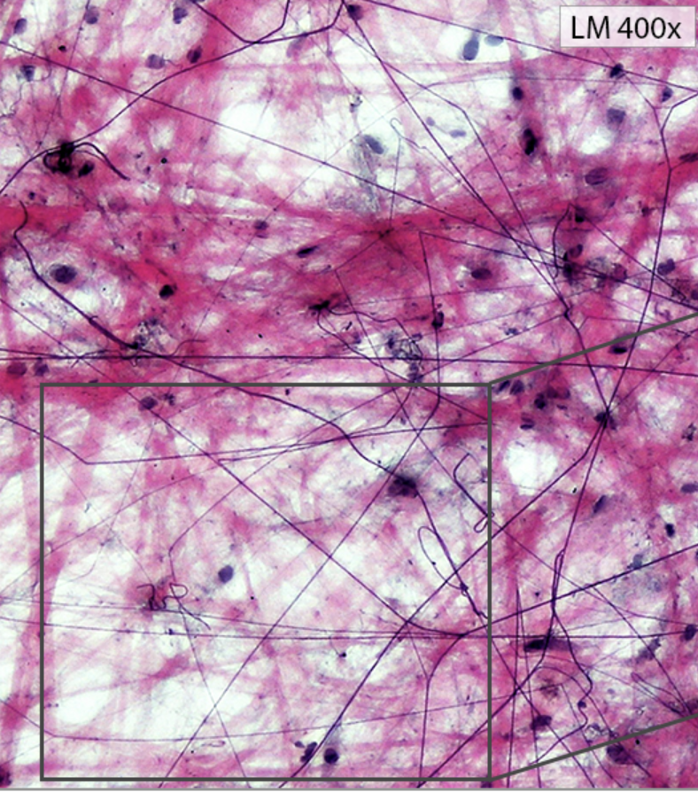 <p>What kind of connective tissue is this?</p>