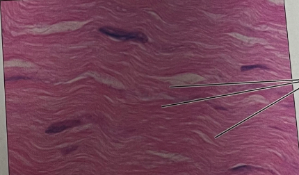 <p>what structure and tissue is this</p>