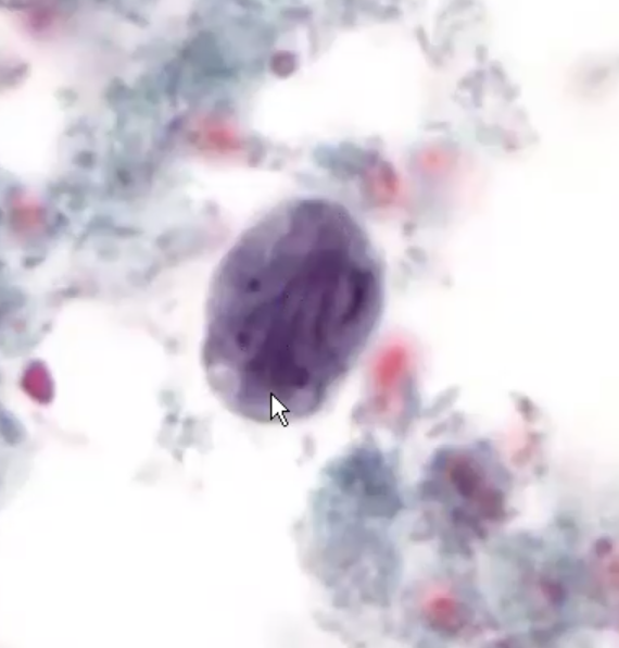 <p>Which Flagellate is this?</p>