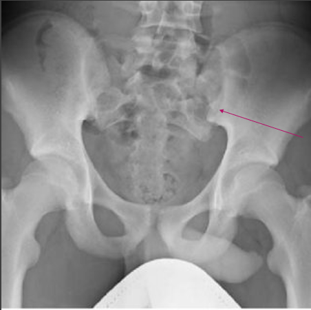 <p>what pathology is this? </p>