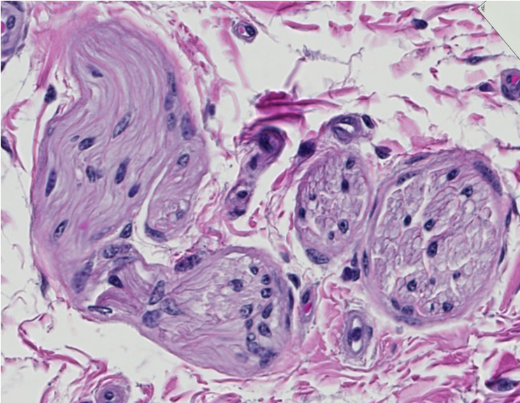 <p><span style="font-family: "Calibri Light";">Is this nerve fascicle myelinated or unmyelinated?</span></p>