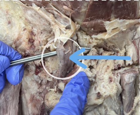 <p>spermatic cord</p>