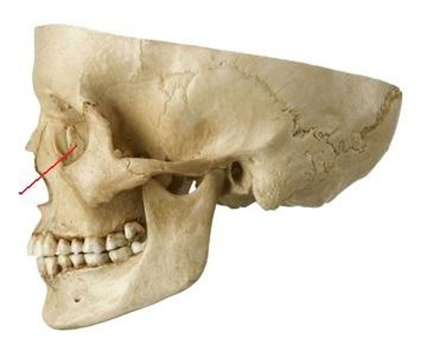 <p>ID bone at arrow</p>