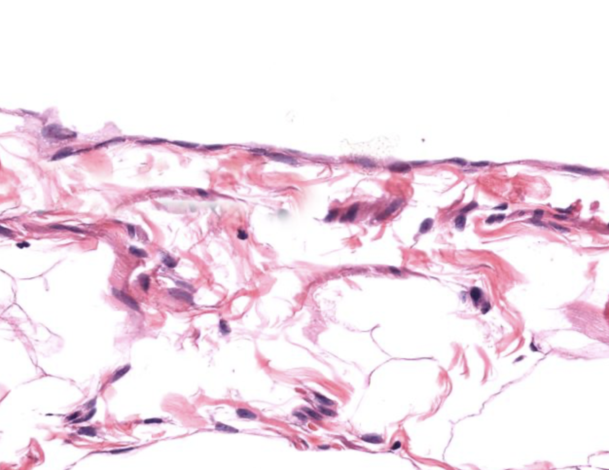 <p>tissue type</p>