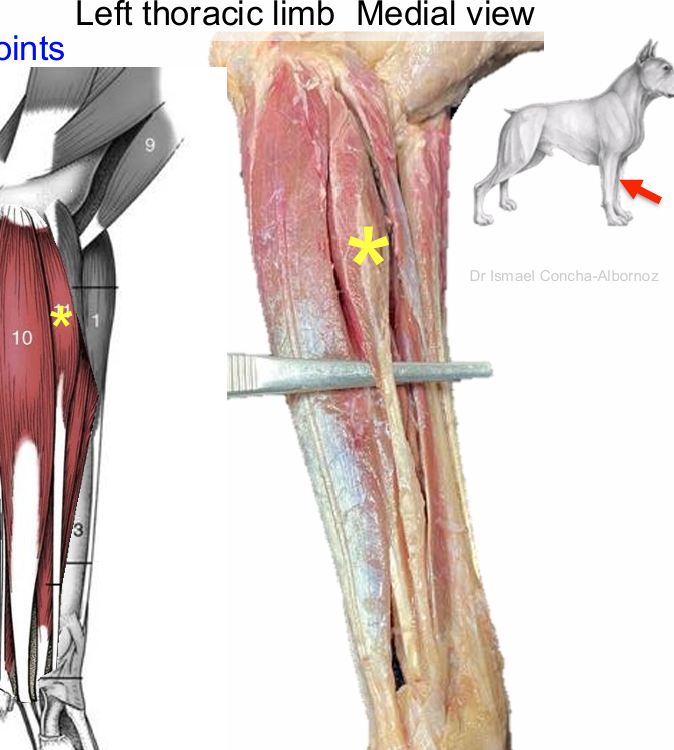 <p>Flexor carpi radialis m.</p>