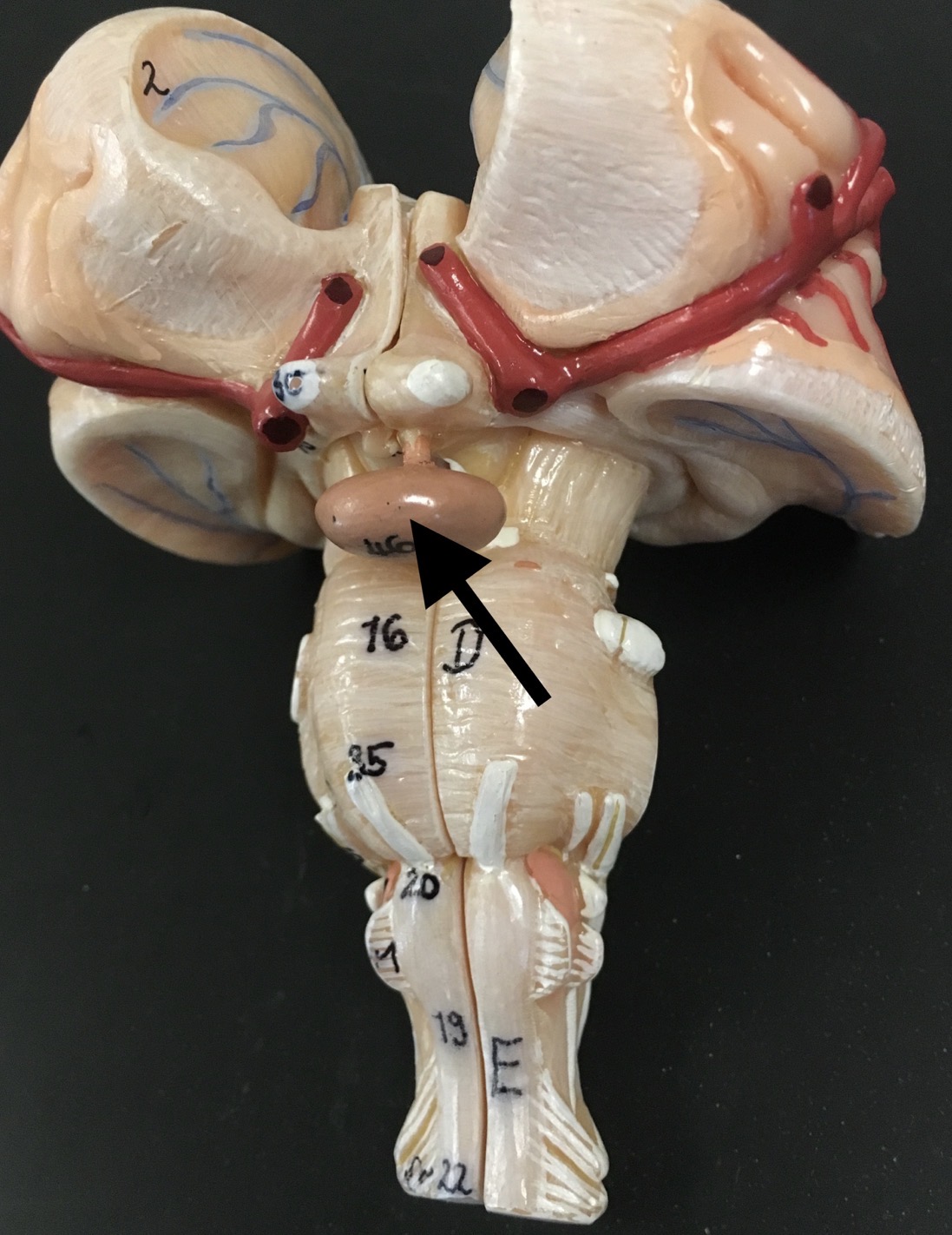 <p>What is the arrow pointing to?</p>