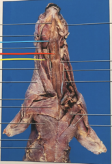 <p>what is the blue line pointing to?</p>