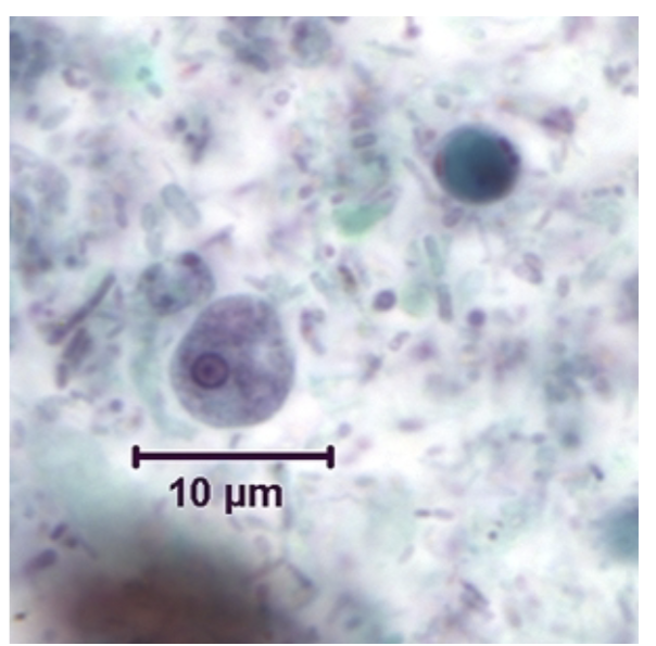 <p>-5-10 microns</p><p>-Looks like a miniature E. histolytica</p><p>-No ingested RBCs</p>
