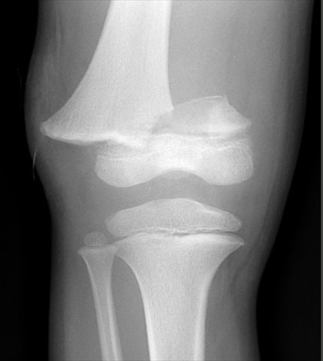 <p>What is the diagnosis?</p>