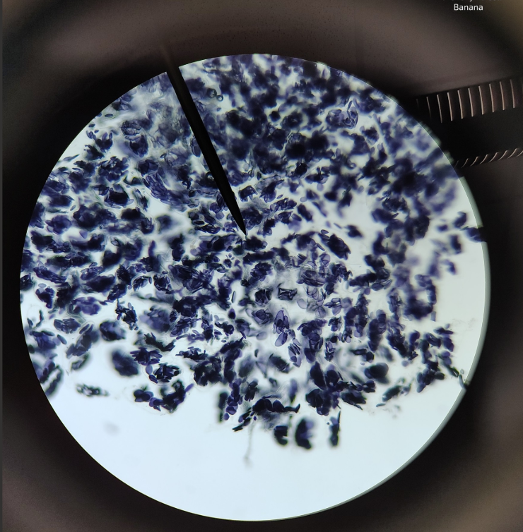 <p>What is it testing for with iodine?</p>