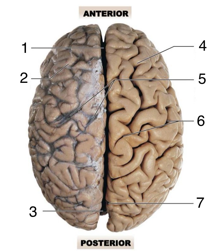 <p>Label the superior anatomy of the Brain</p>