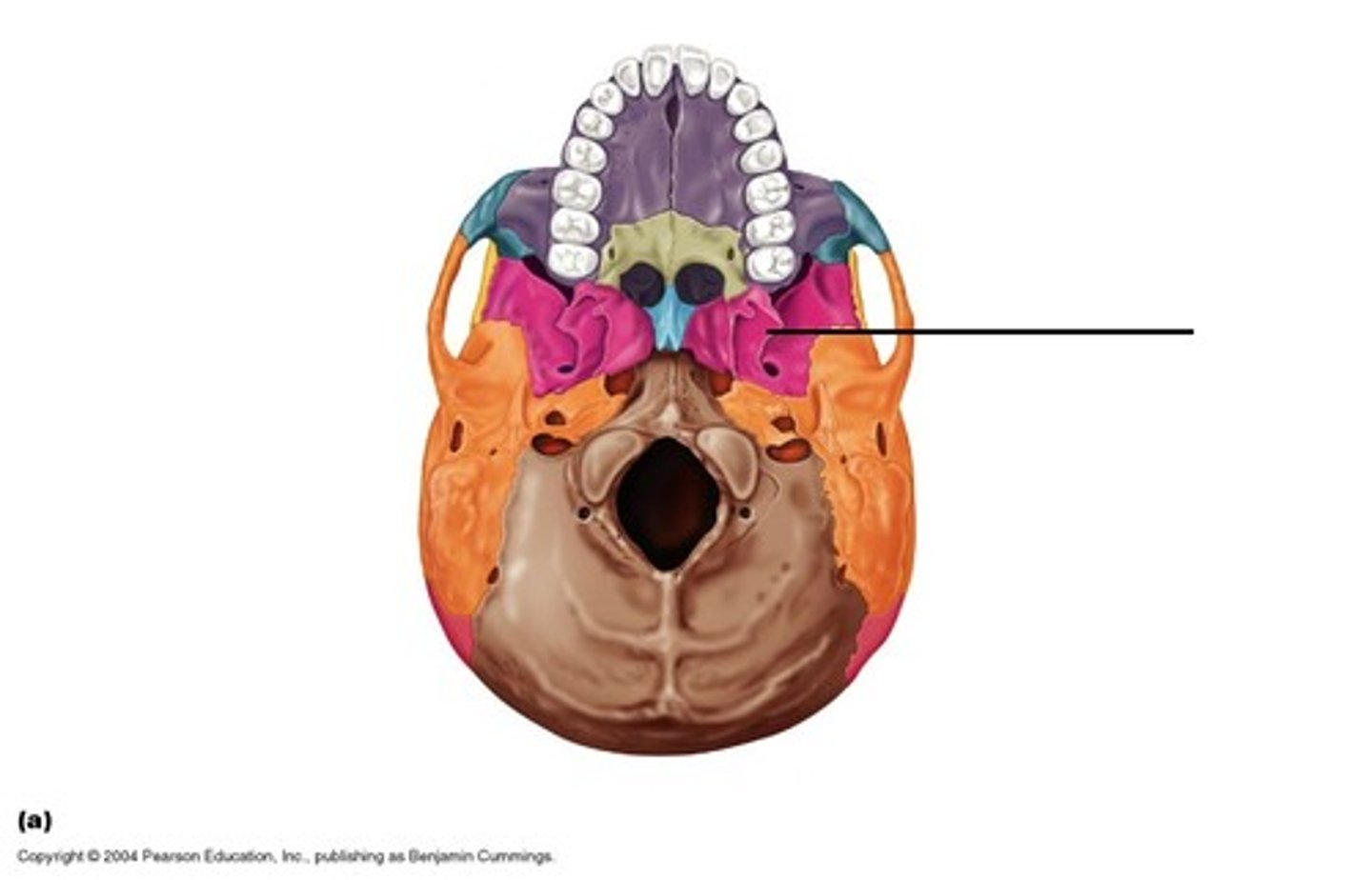 <p>ID bone at arrow</p>