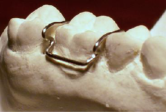 <p>ID the type of clasp:</p>