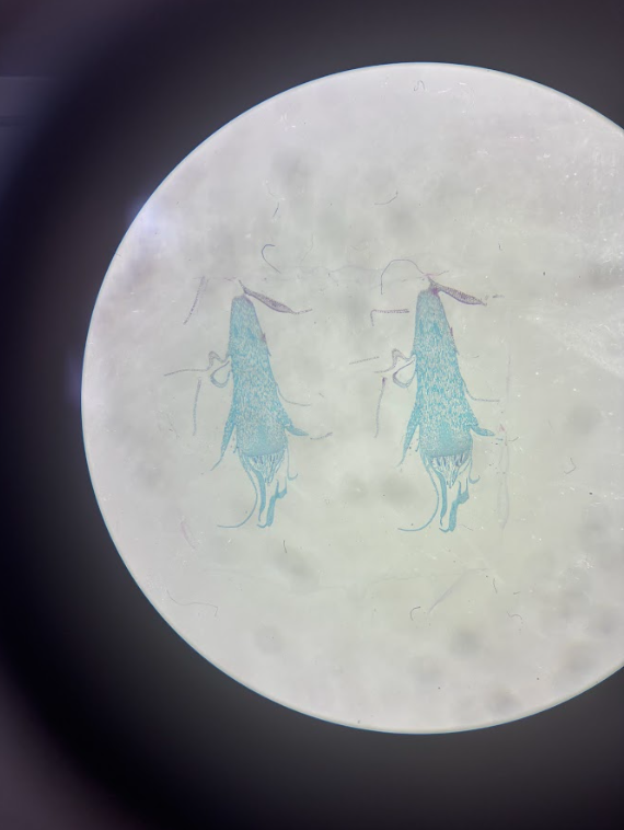 <ul><li><p><strong>Gametophyte</strong></p></li><li><p><strong>Haploid</strong></p></li><li><p>Small chamber containing <strong>egg</strong></p></li><li><p>Sperm must swim to it via water droplets</p></li></ul><p></p>