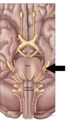 <p>sensory- carries sensations from the face</p><p>Motor- controls muscles of master and buccinator</p>