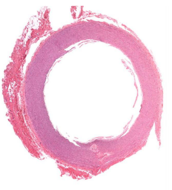 <p>Identify this vessel?</p>