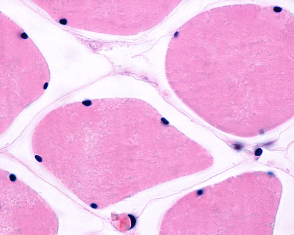 <p>Innermost surrounding layer of muscles, basal lamina and reticular fibers; surrounds single myocyte/myofiber</p>