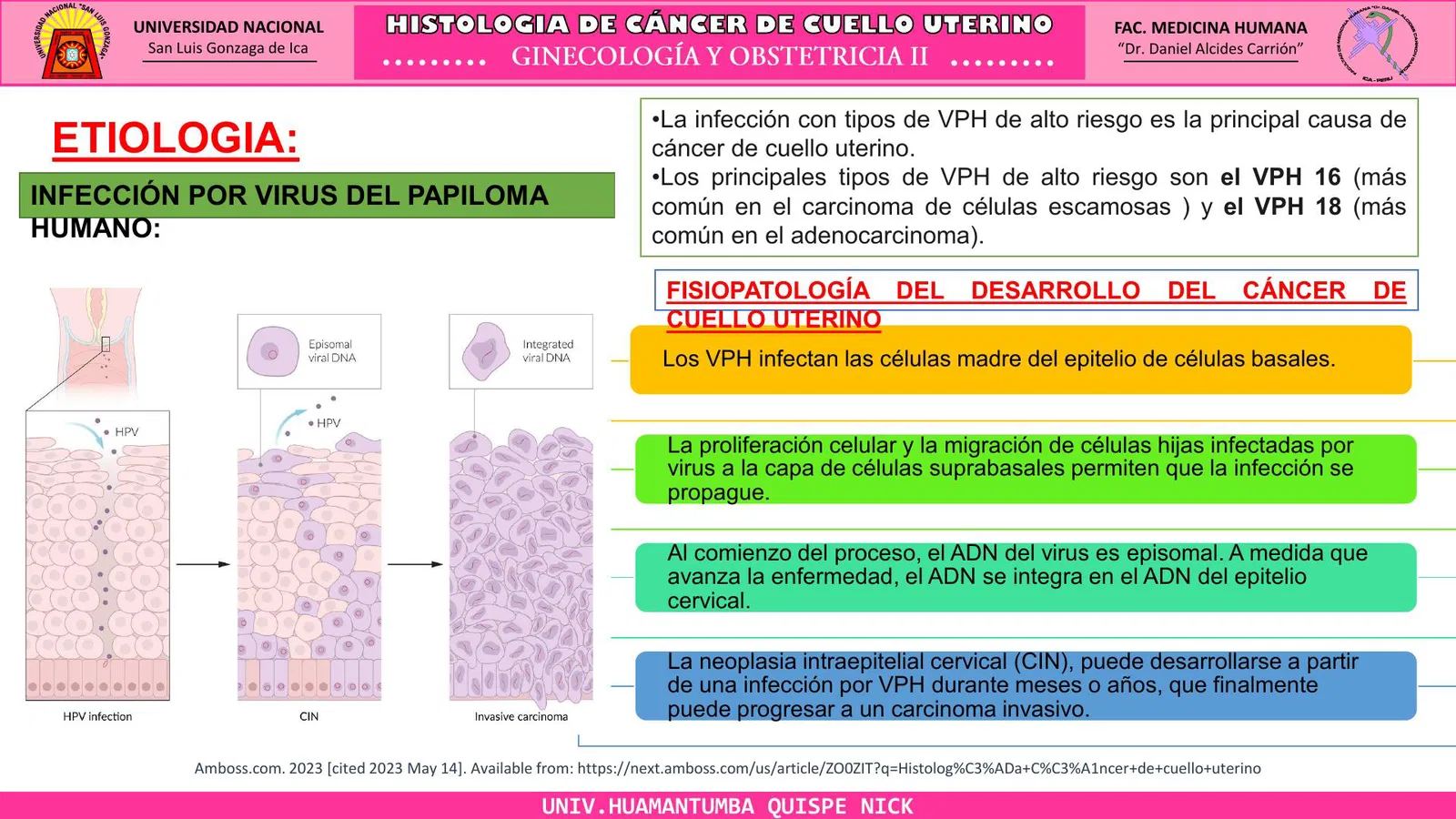 <p>Infección persistente por <strong>VPH (</strong>Virus del papiloma humano) de alto riesgo</p>