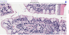 <p>What structure is being indicated by the arrows in this slide of a small intestine?</p>