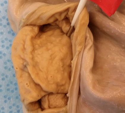 <p>What section of a monogastric stomach does this lining belong in and what are its characteristics and purpose?</p>