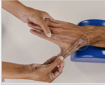 <p>Radial Abduction/Adduction Typical Range of Motion</p>