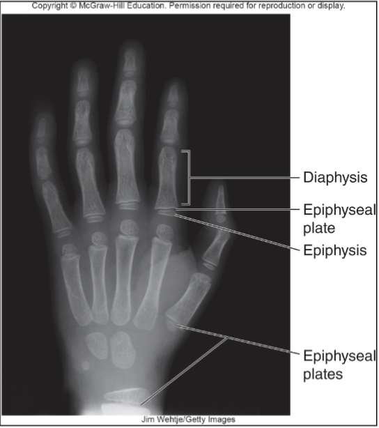 <p>Epiphysis: Ends of long bones composed of cancellous (spongy/trabecular) bone</p><p>Epiphyseal plate (growth plate): Thin cartilage plate that separates the diaphysis from the epiphysis</p>