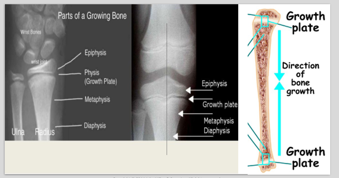 <p>finish bone growth at 18 in females and 21 in males (epiphyseal plates close, cells stop dividing, the plate fades and the epiphyseal line remains) salter (growth plate) fractures may alter growth</p>