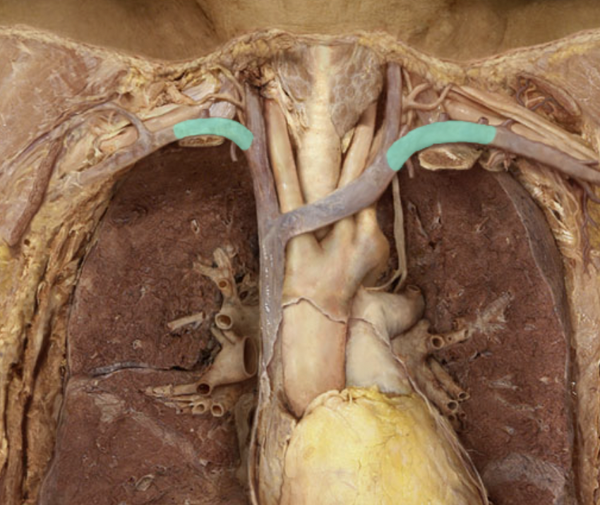 <p>Identify the feature of the superior vena cava</p>