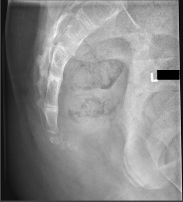 <p>critique for coccyx lateral </p>