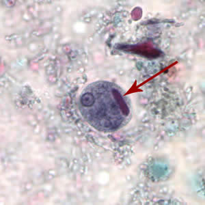 <p>- Chromatid body with blunt rounded ends</p><p>- 4 nuclei</p>