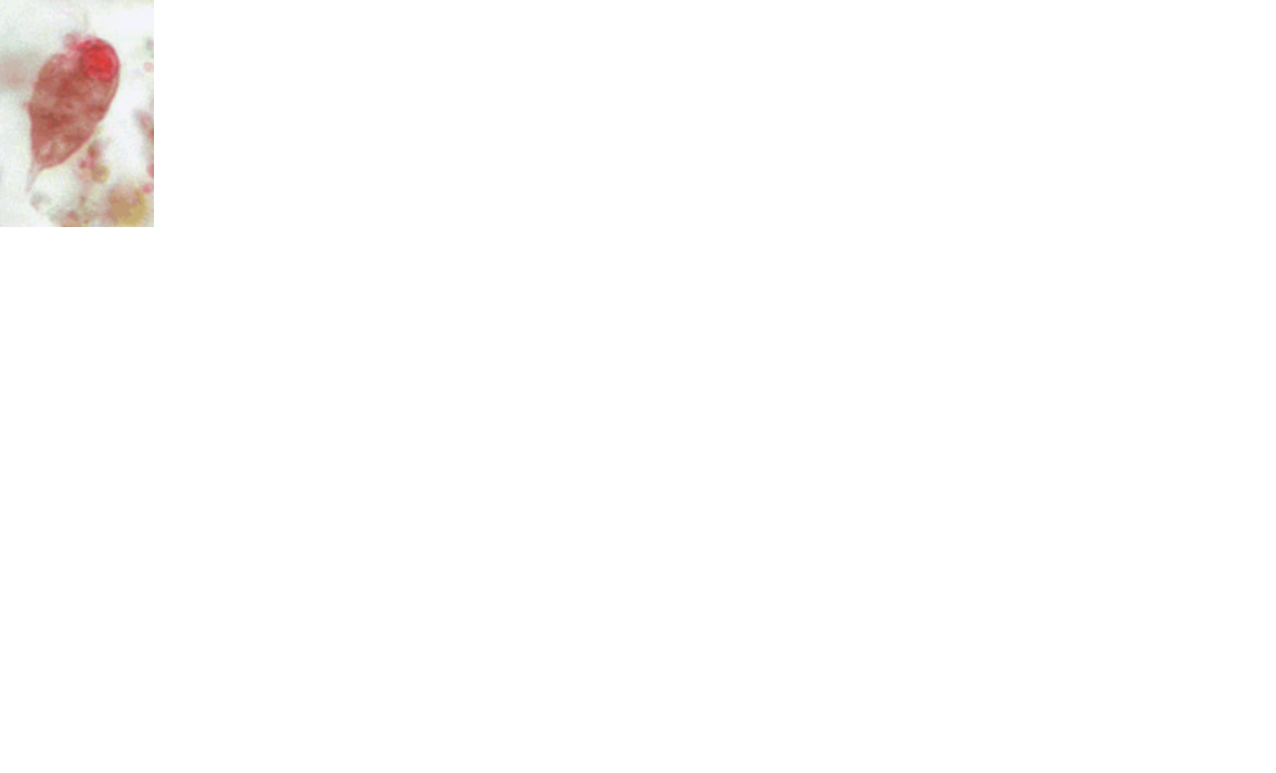 <p>Name the protozoan</p>