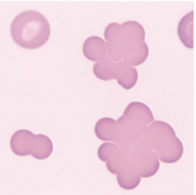 <p>antibodies form bridges between RBCs</p>