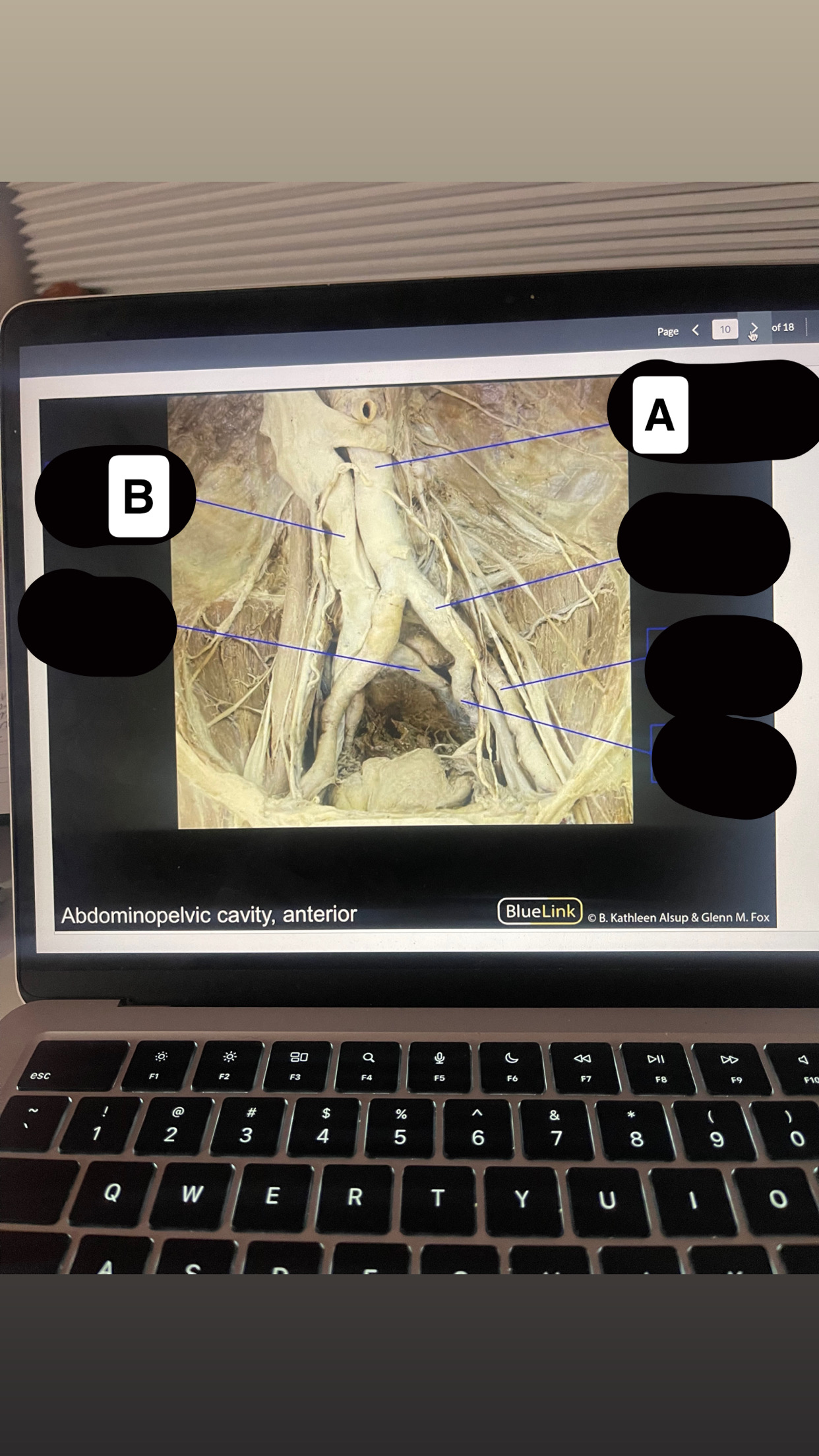<p>Identify vessel letter B</p>