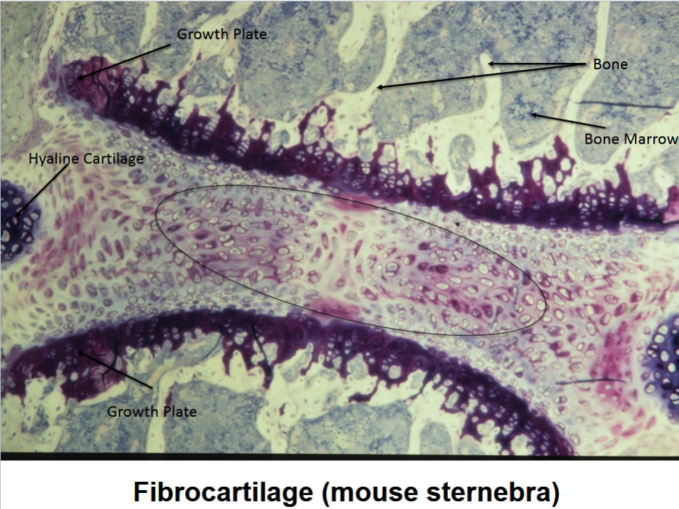 <p>Fibrocartilage</p>