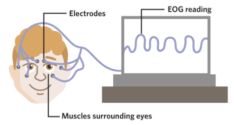 <p><span style="background-color: inherit; line-height: 20.7px; color: windowtext;">An electro-oculograph (EOG) is a device that detects, amplifies, and records the electrical activity of the muscles responsible for eye movement/around the eye</span><span style="line-height: 20.7px; color: windowtext;"> </span></p><ul><li><p class="Paragraph SCXO64806304 BCX0" style="text-align: left;"><span style="background-color: inherit; line-height: 20.7px; color: windowtext;">The movement of these muscles, and therefore movement of the eyes, is measured by electrodes that are attached to the skin above the muscles</span><span style="line-height: 20.7px; color: windowtext;"> </span></p></li><li><p class="Paragraph SCXO64806304 BCX0" style="text-align: left;"><span style="background-color: inherit; line-height: 20.7px; color: windowtext;">TIP: To remember what EOG measures --> think of the middle letter 'O' --> as 'o'ccipital</span><span style="line-height: 20.7px; color: windowtext;"> </span></p></li></ul><p></p>