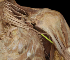<p>Identify the structure</p>