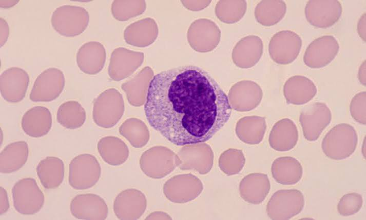 <p>Largest WBC, kidney/U-shaped nucleus</p><p>Become macrophages</p><p>Chronic infections, inflammation</p><p></p>