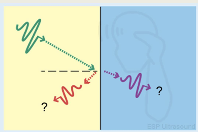 <ol><li><p>Conservation of energy (all energy must be accounted for)</p></li><li><p>Reflection angle = incidence angle (think of looking in a mirror)</p></li></ol><p></p>