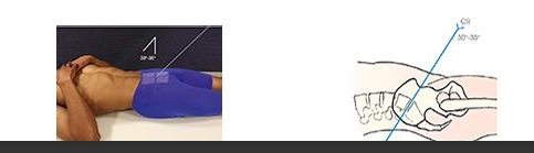 <p>what special view of the L-spine is this?</p>
