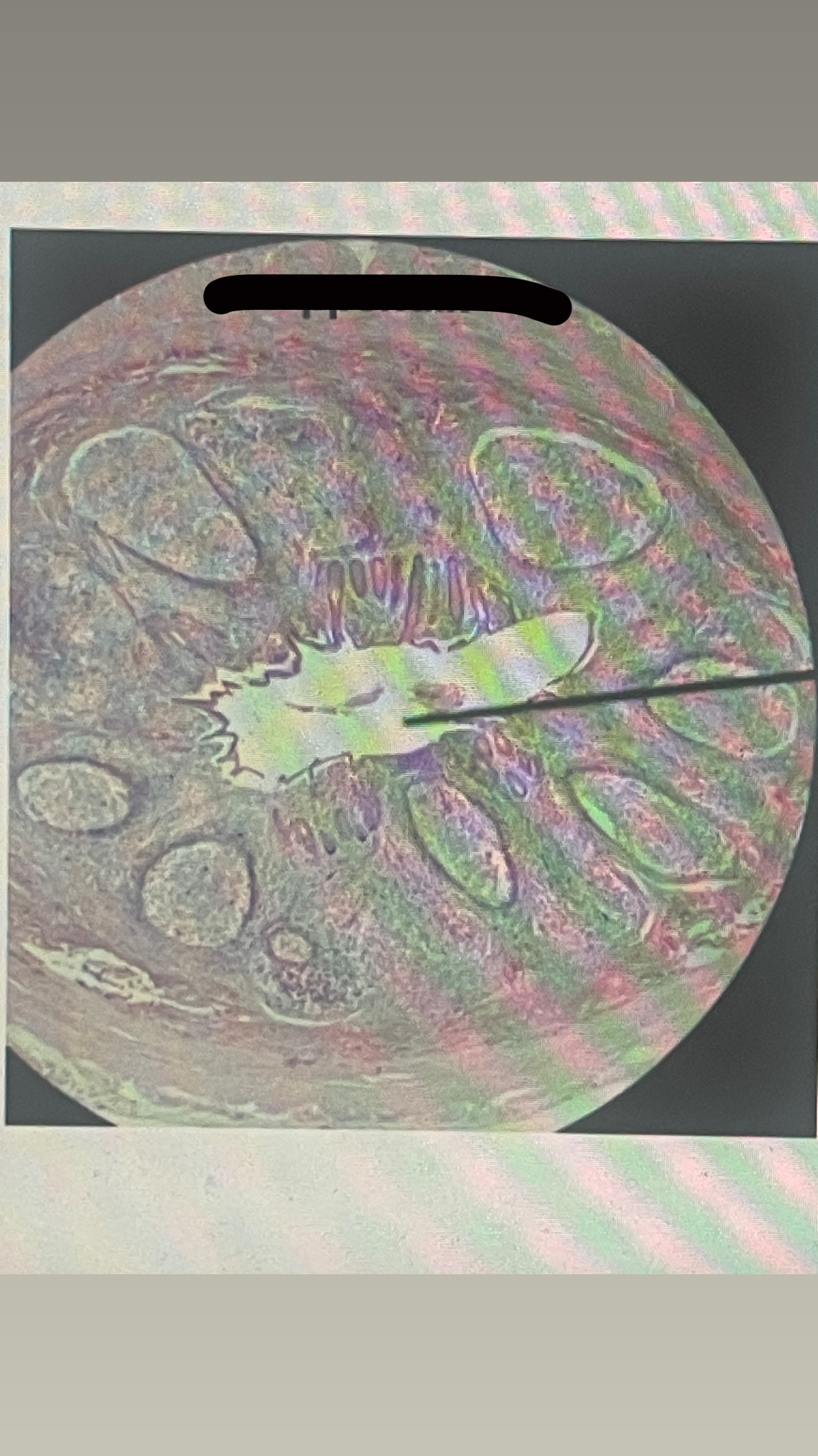 <p>identify lymphatic organ </p>