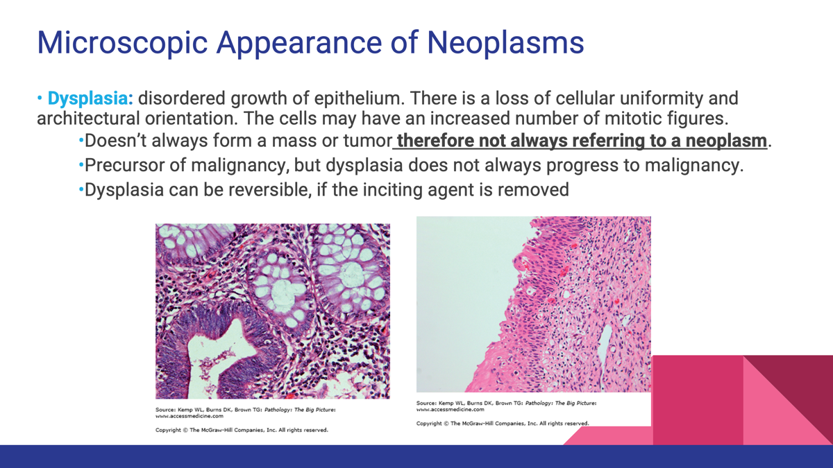 <p><strong>Dysplasia</strong> means disordered growth of epithelial cells.</p><p>Phenotypic changes:</p><ul><li><p>Increased cellularity</p></li><li><p>Hyperchromatic (dark) nuclei</p></li><li><p>Increased mitotic figures</p></li><li><p>Loss of normal cell organization (polarity)</p></li><li><p>Increased nuclear-to-cytoplasmic ratio</p></li></ul><p>At this stage:</p><ul><li><p>Cells look abnormal</p></li><li><p>Basement membrane remains intact</p></li><li><p>May be reversible if the cause is removed</p></li></ul><p><span data-name="pushpin" data-type="emoji">📌</span> <strong>Not yet cancer</strong>, but often a precursor to cancer.</p><p></p><p></p>