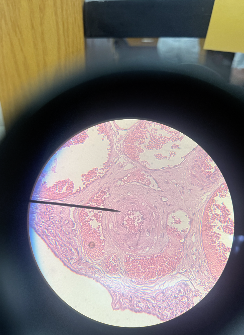 term image